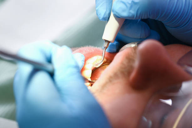 Best Emergency TMJ Treatment in Tyler, TX