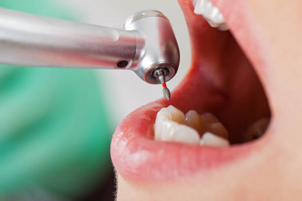 Best Pediatric Emergency Dentist in Tyler, TX